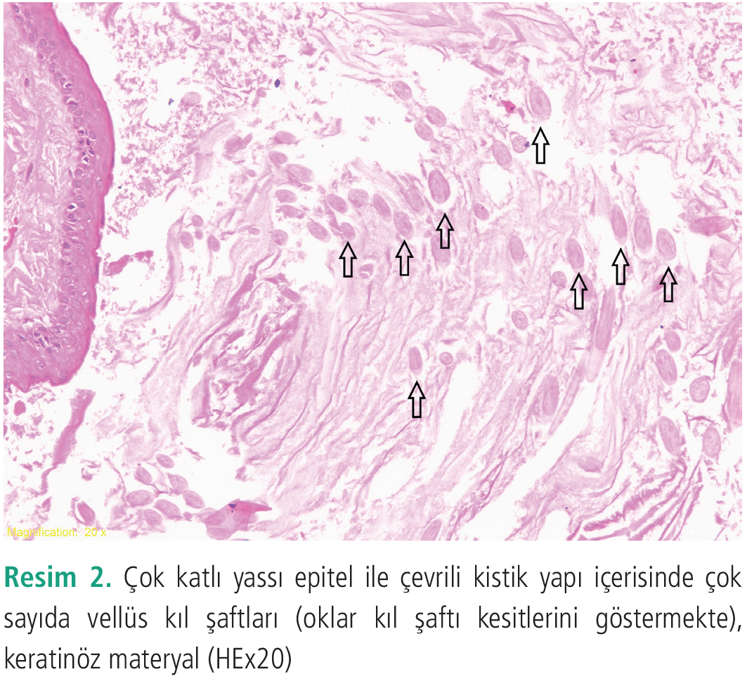 Dermatoz-10-96-g2.png