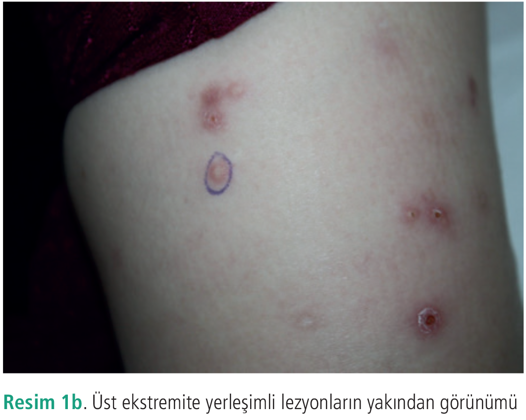 Dermatoz-11-21-g2.png