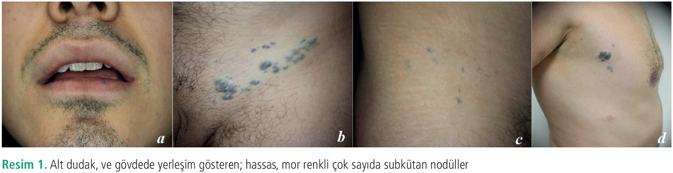 Dermatoz-11-56-g1.png