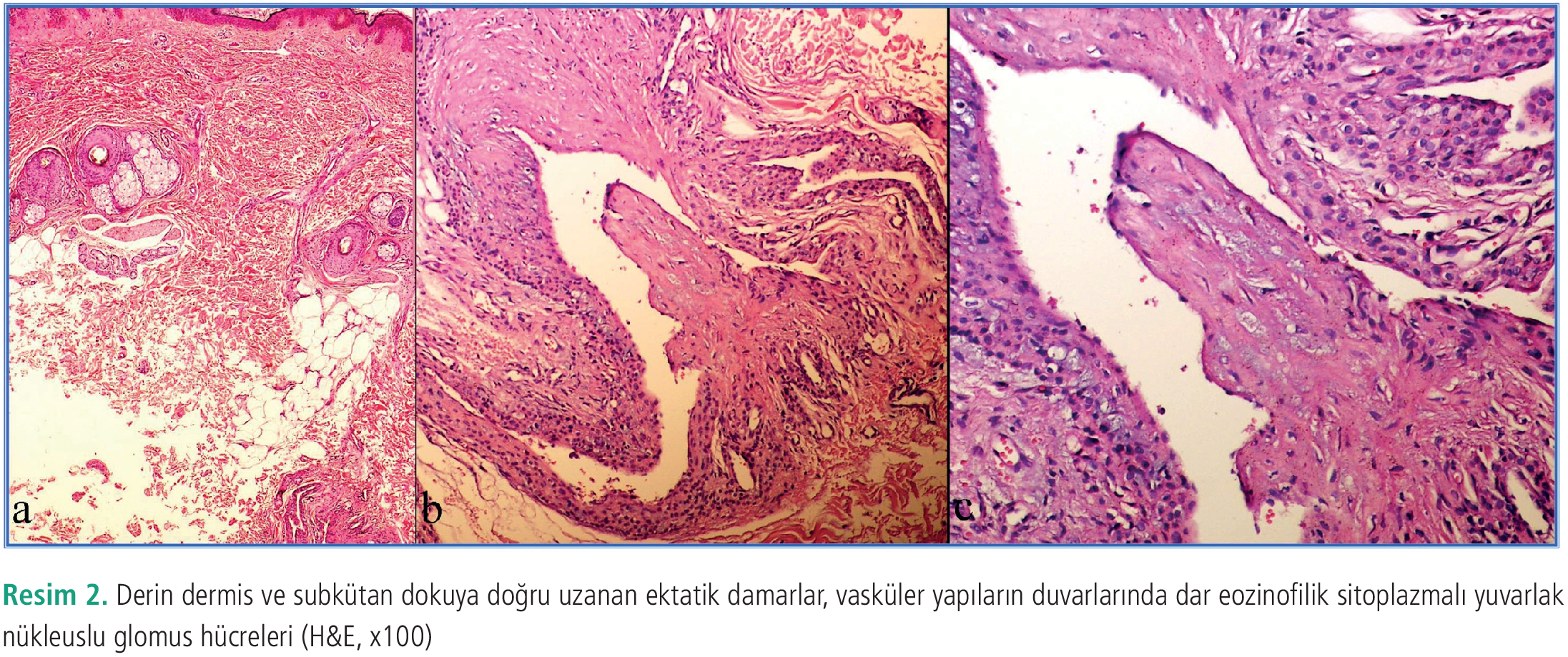 Dermatoz-11-56-g2.png